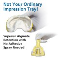 DuraLock-Plus-Impression-Trays-in-use.jpg